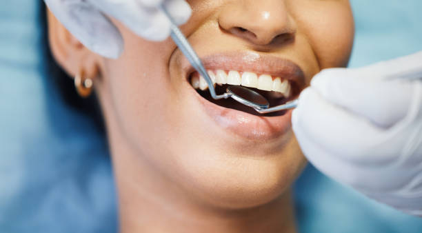 Best Emergency Treatment for Dental Infections or Abscesses in Oakland, CA