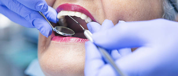 Best Weekend Emergency Dentist in Oakland, CA