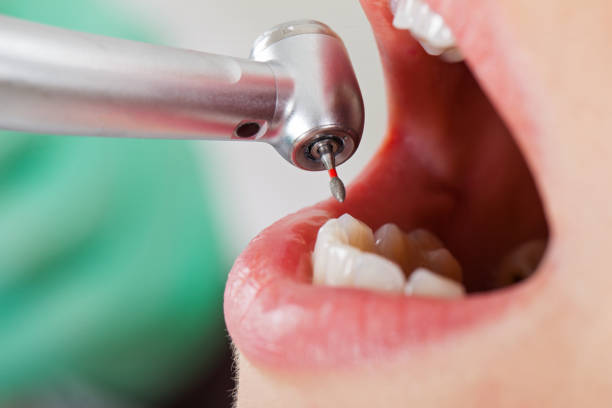 Best Cosmetic Emergency Dentistry in Oakland, CA